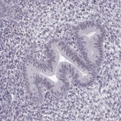 Invitrogen NANOS3 Polyclonal Antibody 100 &mu;L; Unconjugated:Antibodies,