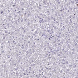 Invitrogen ULBP3 Polyclonal Antibody 100 &mu;L; Unconjugated:Antibodies,