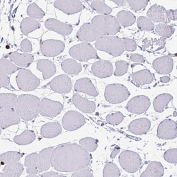 Invitrogen ULBP3 Polyclonal Antibody 100 &mu;L; Unconjugated:Antibodies,