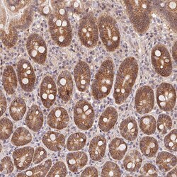Invitrogen SLC52A2 Polyclonal Antibody 100 &mu;L; Unconjugated:Antibodies,