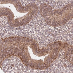 Invitrogen SLC52A2 Polyclonal Antibody 100 &mu;L; Unconjugated:Antibodies,