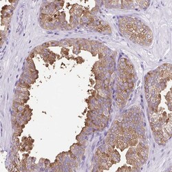 Invitrogen FAM177B Polyclonal Antibody 100 &mu;L; Unconjugated:Antibodies,