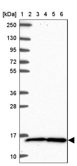 Invitrogen TAX1BP3 Polyclonal Antibody 100 &mu;L; Unconjugated:Antibodies,