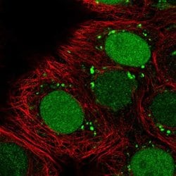 Invitrogen HELLS Polyclonal Antibody 100 &mu;L; Unconjugated:Antibodies,