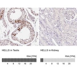 Invitrogen HELLS Polyclonal Antibody 100 &mu;L; Unconjugated:Antibodies,