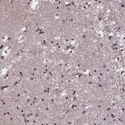 Invitrogen TEB4 Polyclonal Antibody 100 &mu;L; Unconjugated:Antibodies,