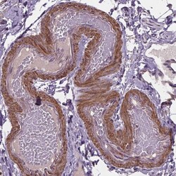 CLN3 Polyclonal Antibody:Antibodies, Polyclonal