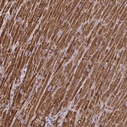Invitrogen MT-ND3 Polyclonal Antibody 100 &mu;L; Unconjugated:Antibodies,
