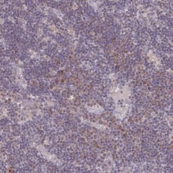 Invitrogen MT-ND3 Polyclonal Antibody 100 &mu;L; Unconjugated:Antibodies,