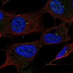 Invitrogen UBE2Q1 Polyclonal Antibody 100 &mu;L; Unconjugated:Antibodies,