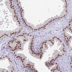 Invitrogen UBE2Q1 Polyclonal Antibody 100 &mu;L; Unconjugated:Antibodies,
