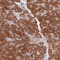 Invitrogen RPL27A Polyclonal Antibody 100 &mu;L; Unconjugated:Antibodies,