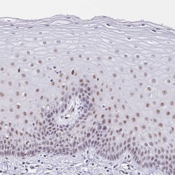 Invitrogen ZNF860 Polyclonal Antibody 100 &mu;L; Unconjugated:Antibodies,