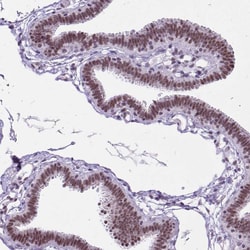 Invitrogen ZNF860 Polyclonal Antibody 100 &mu;L; Unconjugated:Antibodies,