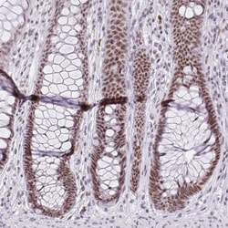 Invitrogen ZNF860 Polyclonal Antibody 100 &mu;L; Unconjugated:Antibodies,