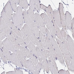 Invitrogen ZNF860 Polyclonal Antibody 100 &mu;L; Unconjugated:Antibodies,