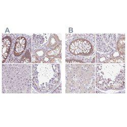 Invitrogen RSL24D1 Polyclonal Antibody 100 &mu;L; Unconjugated:Antibodies,