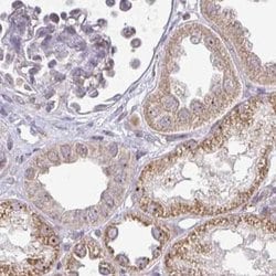 Invitrogen RSL24D1 Polyclonal Antibody 100 &mu;L; Unconjugated:Antibodies,
