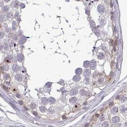 Invitrogen RSL24D1 Polyclonal Antibody 100 &mu;L; Unconjugated:Antibodies,