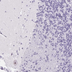 Invitrogen ST8SIA3 Polyclonal Antibody 100 &mu;L; Unconjugated:Antibodies,