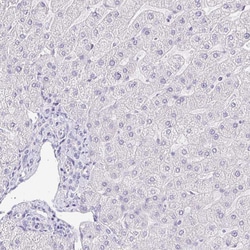 KRTDAP Polyclonal Antibody:Antibodies, Polyclonal