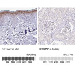 KRTDAP Polyclonal Antibody:Antibodies, Polyclonal