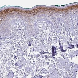 KRTDAP Polyclonal Antibody:Antibodies, Polyclonal