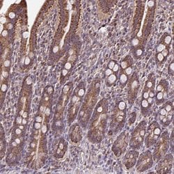 Invitrogen MAN1A1 Polyclonal Antibody 100 &mu;L; Unconjugated:Antibodies,