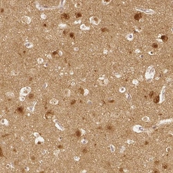 Invitrogen SGTB Polyclonal Antibody 100 &mu;L; Unconjugated:Antibodies,