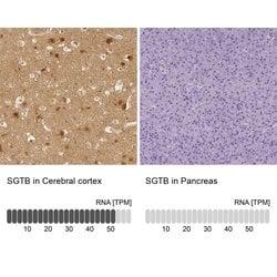 Invitrogen SGTB Polyclonal Antibody 100 &mu;L; Unconjugated:Antibodies,