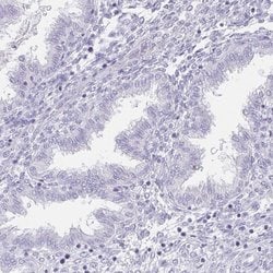 Invitrogen HDGFL1 Polyclonal Antibody 100 &mu;L; Unconjugated:Antibodies,