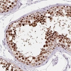 Invitrogen HDGFL1 Polyclonal Antibody 100 &mu;L; Unconjugated:Antibodies,