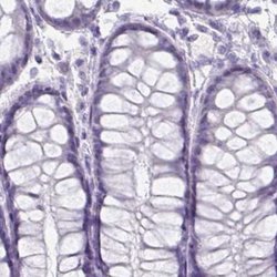 Invitrogen HDGFL1 Polyclonal Antibody 100 &mu;L; Unconjugated:Antibodies,