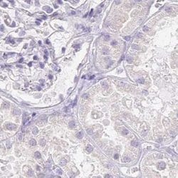 Invitrogen HDGFL1 Polyclonal Antibody 100 &mu;L; Unconjugated:Antibodies,