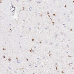 Invitrogen RIAM Polyclonal Antibody 100 &mu;L; Unconjugated:Antibodies,