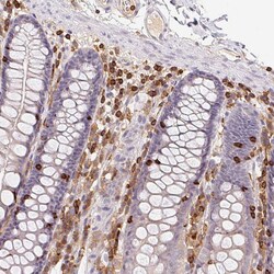 Invitrogen RIAM Polyclonal Antibody 100 &mu;L; Unconjugated:Antibodies,