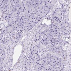 Invitrogen RIAM Polyclonal Antibody 100 &mu;L; Unconjugated:Antibodies,
