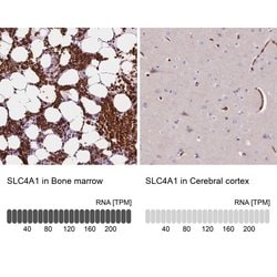 Invitrogen SLC4A1 Polyclonal Antibody 100 &mu;L; Unconjugated:Antibodies,