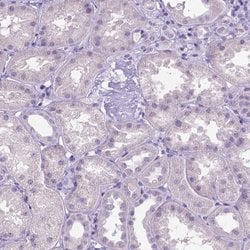 Invitrogen SLC35C1 Polyclonal Antibody 100 &mu;L; Unconjugated:Antibodies,