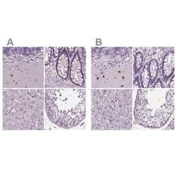 Invitrogen BHLHB5 Polyclonal Antibody 100 &mu;L; Unconjugated:Antibodies,