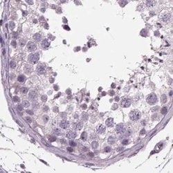 Invitrogen BHLHB5 Polyclonal Antibody 100 &mu;L; Unconjugated:Antibodies,