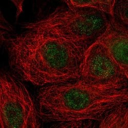 Invitrogen TMEM118 Polyclonal Antibody 100 &mu;L; Unconjugated:Antibodies,