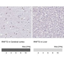 Invitrogen TMEM118 Polyclonal Antibody 100 &mu;L; Unconjugated:Antibodies,