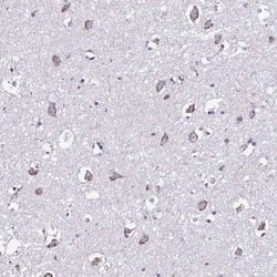 Invitrogen TMEM118 Polyclonal Antibody 100 &mu;L; Unconjugated:Antibodies,