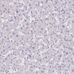 Invitrogen TMEM118 Polyclonal Antibody 100 &mu;L; Unconjugated:Antibodies,