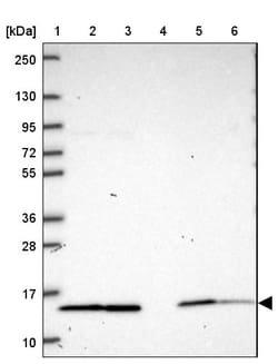 Invitrogen NDUFS6 Polyclonal Antibody 100 &mu;L; Unconjugated:Antibodies,