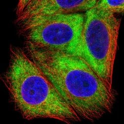 RPS16 Polyclonal Antibody:Antibodies, Polyclonal