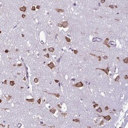 RPS16 Polyclonal Antibody:Antibodies, Polyclonal
