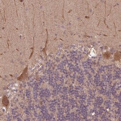 CUTA Polyclonal Antibody:Antibodies, Polyclonal