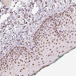 Invitrogen DPPA5 Polyclonal Antibody 100 &mu;L; Unconjugated:Antibodies,